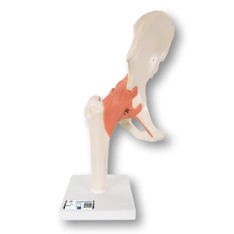 Modèle fonctionnel de luxe de l'articulation de la hanche - Anatomie et pathologie