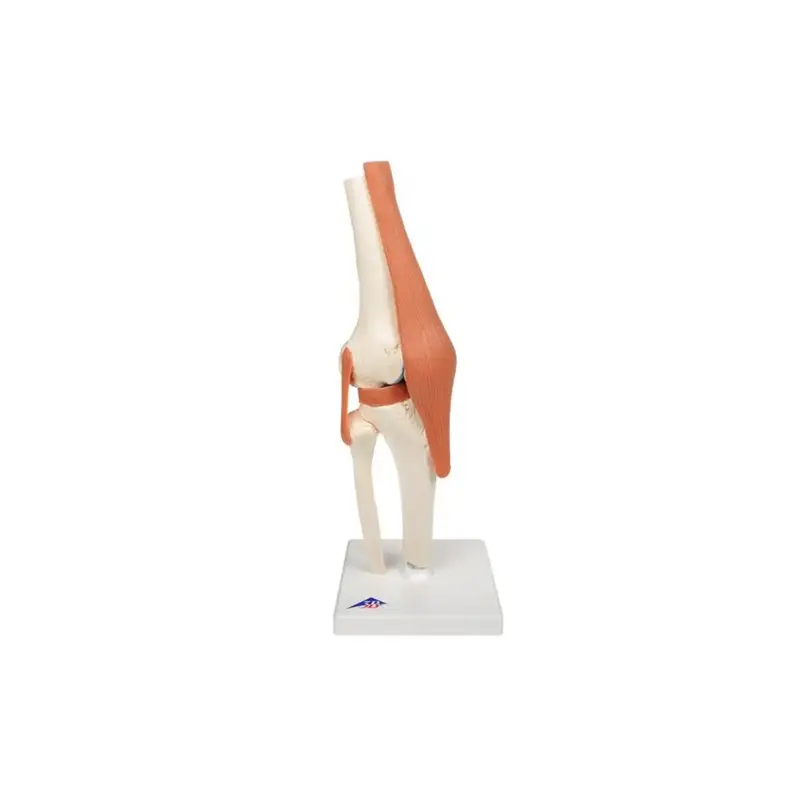 Modèle fonctionnel de luxe de l'articulation du genou - Anatomie et pathologie